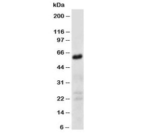 Western blot testing of CD147 antibody and human fibroma cell lysate. Predicted molecular weight: ~2