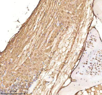 IHC staining of FFPE zebrafish spinal cord tissue with Cdc48 antibody, HRP-labeled secondary and DAB