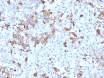 Prolactin Antibody / PRL