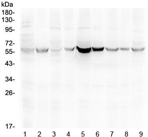 Western blot testing of 1) rat testis, 2) rat ovary, 3) mouse testis, 4) rat ovary, 5) human HeLa, 6
