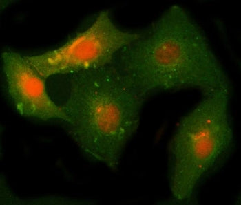 NCAPH Antibody / Condensin complex subunit 2