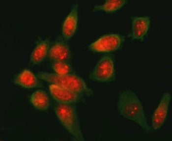 ATF6 Antibody / Activating transcription factor 6