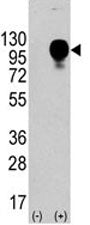 Western blot analysis of CD107b antibody and 293 cell lysate nontransfected or transfected. The prot