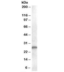 Western blot testing of human kidney lysate with CLEC1B antibody at 1ug/ml. Predicted molecular weig
