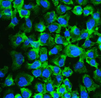 Immunofluorescent staining of FFPE human A431 cells with EIF4A2 antibody (green) and DAPI nuclear st