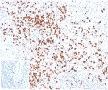 Lysozyme C Antibody / LYZ