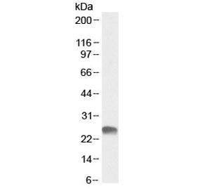Western blot testing of human placental lysate with GSTA3 antibody at 0.3ug/ml. Predicted molecular 