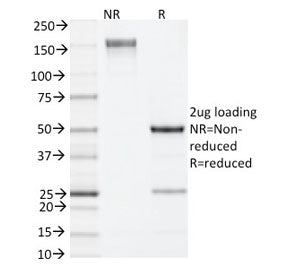 IL-4 Antibody