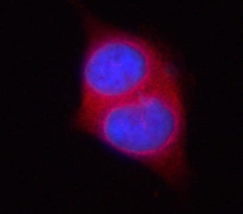 Immunofluorescent staining of FFPE human PC-3 cells with Phosphoserine aminotransferase antibody (re