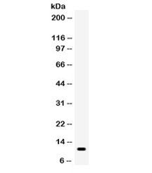 Western blot testing of human HUT cell lysate with CCL5 antibody. Expected/observed molecular weight