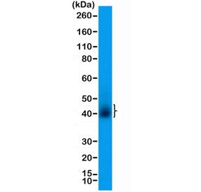 Western blot testing of human T-cell lysate with recombinant CD28 antibody at 1:200 dilution. Expect