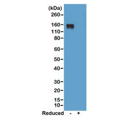 Western blot of nonreduced(-) and reduced(+) mouse IgG2a, using 0.5ug/ml of recombinant Mouse IgG2a 