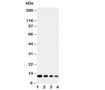 Western blot testing of Eotaxin antibody and Lane 1: recombinant mouse protein 10ng; 2: 5ng; 3: 2.5n