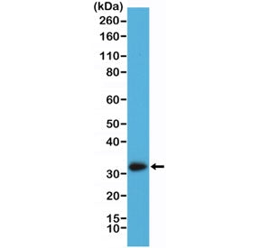 Western blot testing of human A431 cell lysate with recombinant Calretinin antibody at 1:2000. Predi