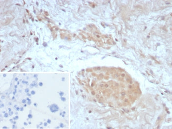 Survivin Antibody / BIRC5