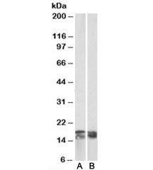 Western blot testing of human tonsil [A] and Jurkat [B] lysates with CD3 zeta antibody at 0.03ug/ml.
