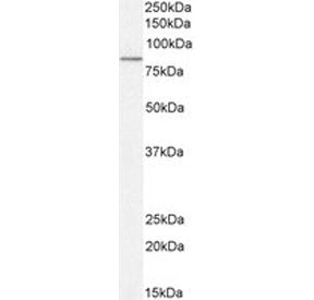 Western blot testing of human placental tissue lysate with TG2 antibody. Predicted molecular weight: