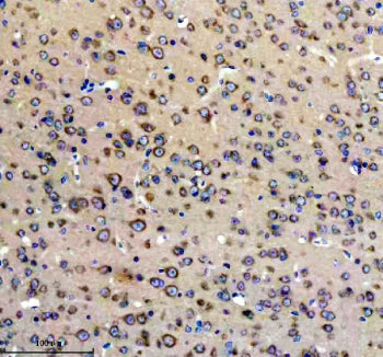 GLUR2 Antibody / Glutamate Receptor 2 / GRIA2, 100ul