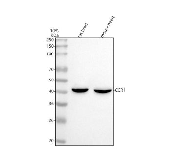 Western blot analysis of CCR1 using anti-CCR1 antibody. Lane 1: rat heart tissue lysates, Lane 2: mo