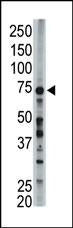 FACL6 antibody used in western blot to detect FACL6 in mouse liver tissue lysate