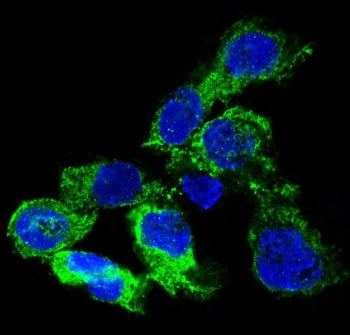 IF/ICC staining of HUVEC with VEGFA antibody (green) and DAPI nuclear stain (blue).