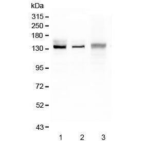 Ceruloplasmin Antibody / CP