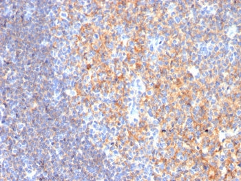 IHC staining of FFPE human tonsil with CD19 antibody (clone CD19/3116). HIER: boil tissue sections i