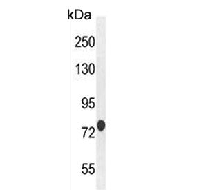 Western blot testing of human CEM cell lysate with ATF7IP2 antibody. Predicted molecular weight ~76 
