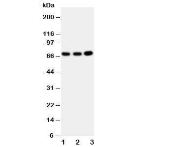 Western blot testing of GBP1 antibody and Lane 1: U87; 2: HeLa; 3: MCF-7 cell lysate