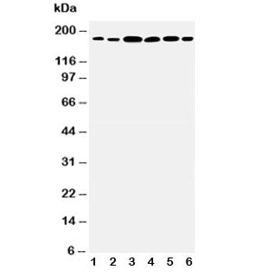 Western blot testing of Laminin gamma 1 antibody and Lane 1: rat kidney; 2: rat lung; 3: U87; 4: SMM