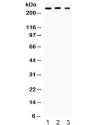 SCNA1 Antibody / Nav1.1