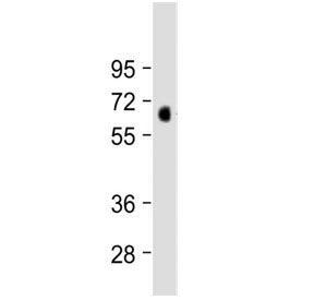 Western blot testing of human lung tissue lysate with MKS1 antibody at 1:2000. Predicted molecular w