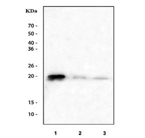 Western blot testing of 1) human A431, 2) rat PC-12 and 3) mouse brain tissue lysate with CIB1 antibody. Predicted molecular weight ~21 kDa.