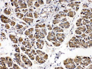 Alpha Amylase 1 Antibody