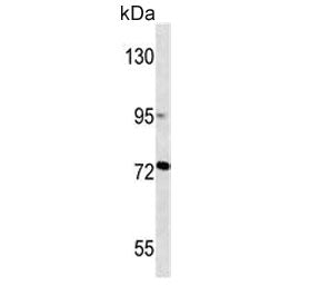 Western blot testing of human T-47D cell lysate with MMP2 antibody. Predicted molecular weight ~72 k