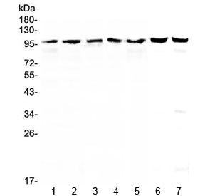 Western blot testing of human 1) HeLa, 2) COLO320, 3) HepG2, 4) A431, 5) SK-OV-3, 6) rat testis and 
