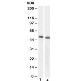 Western blot testing of human 1) Jurkat and 2) K562 cell lysate with DPF2 antibody at 1ug/ml. Predic