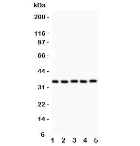 Western blot testing of HOXA11 antibody and Lane 1: rat brain; 2: human placenta; 3: human HeLa; 4: 