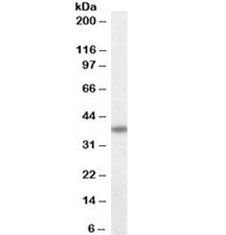 Western blot testing of MOLT4 lysate with Fas antibody at 0.1ug/ml. Predicted molecular weight: ~38 