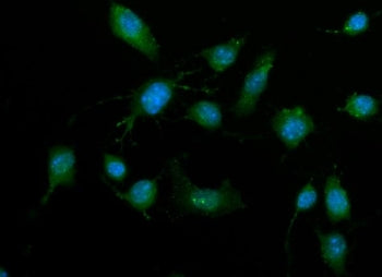Dapk3 Antibody / Death-associated protein kinase 3 / Zip kinase