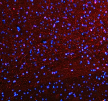 Immunofluorescent staining of FFPE mouse brain tissue with SERT antibody (red) and DAPI nuclear stai
