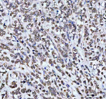 Immunohistochemical staining of AHCY using anti-AHCY antibody. AHCY was detected in a paraffin-embed