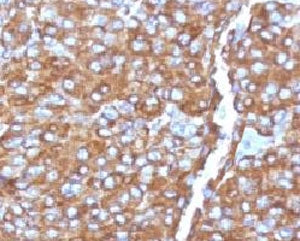 IHC analysis of formalin-fixed, paraffin-embedded human adrenal gland stained with Chromogranin A an