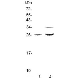 Western blot testing of rat 1) PC-12 and 2) RH35 lysate with Betacellulin antibody at 0.5ug/ml. Expe