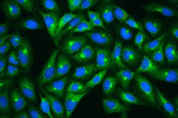 HSP27 Antibody