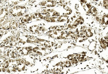 IHC testing of FFPE human stomach tissue with APE1 antibody. HIER: steam section in pH6 citrate buff