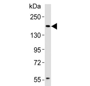 Insulin Receptor Related Antibody (INSRR)