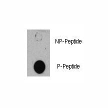 Dot blot analysis of phospho-TSC1 antibody. 50ng of phos-peptide or nonphos-peptide per dot were spo