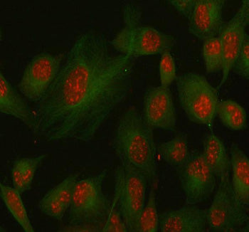 Immunofluorescent staining of SSH3 using anti-SSH3 antibody (red) and anti-Beta Tubulin antibody (gr