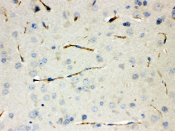 CGRP Antibody / CALCA